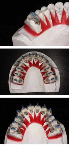 専門の歯科技工士